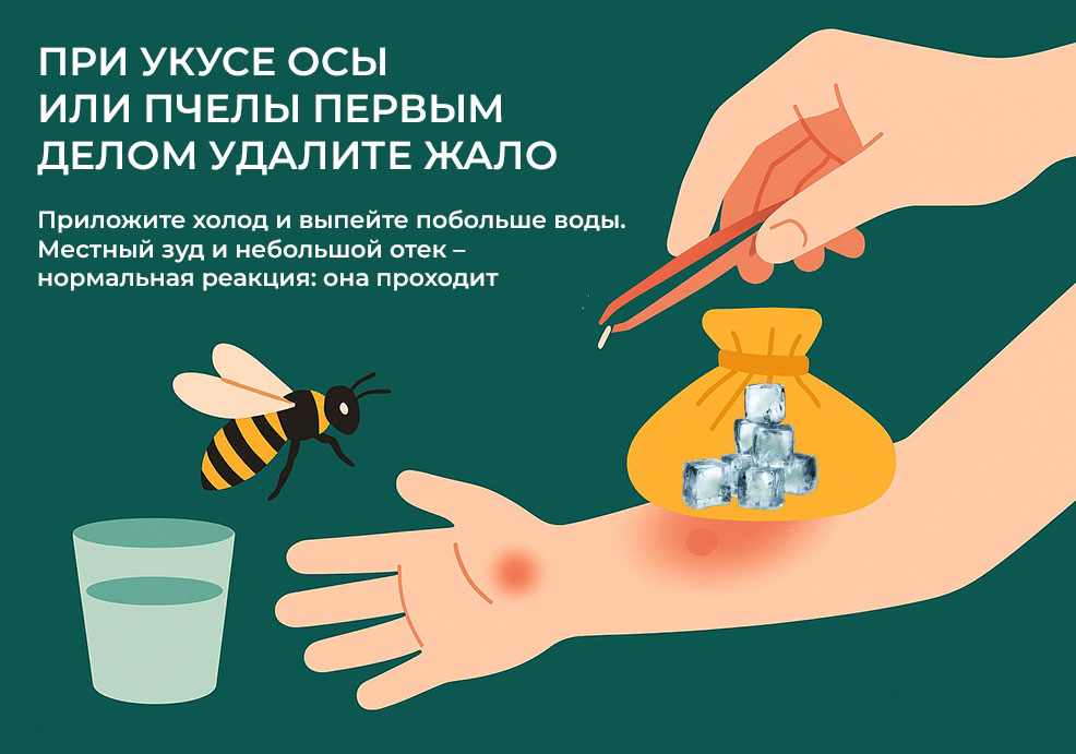 первая-помощь-при-укусе-осы-или-пчелы